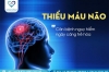 THIẾU MÁU NÃO