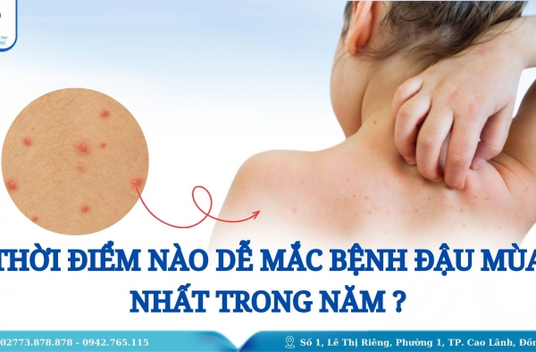 THỜI ĐIỂM NÀO DỄ MẮC BỆNH THỦY ĐẬU NHẤT TRONG NĂM