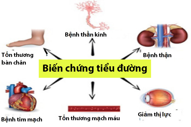 phong-ngua-bien-chung-tieu-duong1