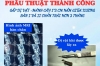 Phẫu thuật thành công gắp dị vật  - mảnh cây 1 * 3 cm nằm giữa xương bàn I và II chân trái hơn 3 tháng