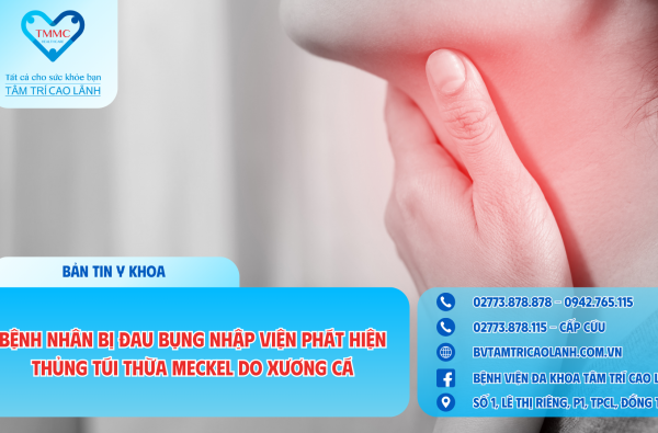 BỆNH NHÂN BỊ ĐAU BỤNG NHẬP VIỆN PHÁT HIỆN THỦNG TÚI THỪA MECKEL DO XƯƠNG CÁ