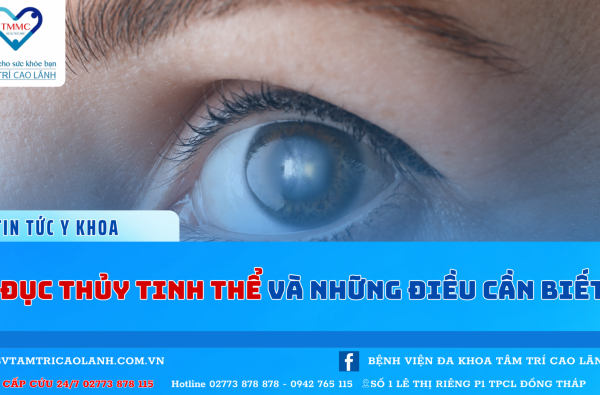 ĐỤC THỦY TINH THỂ VÀ NHỮNG ĐIỀU CẦN BIẾT