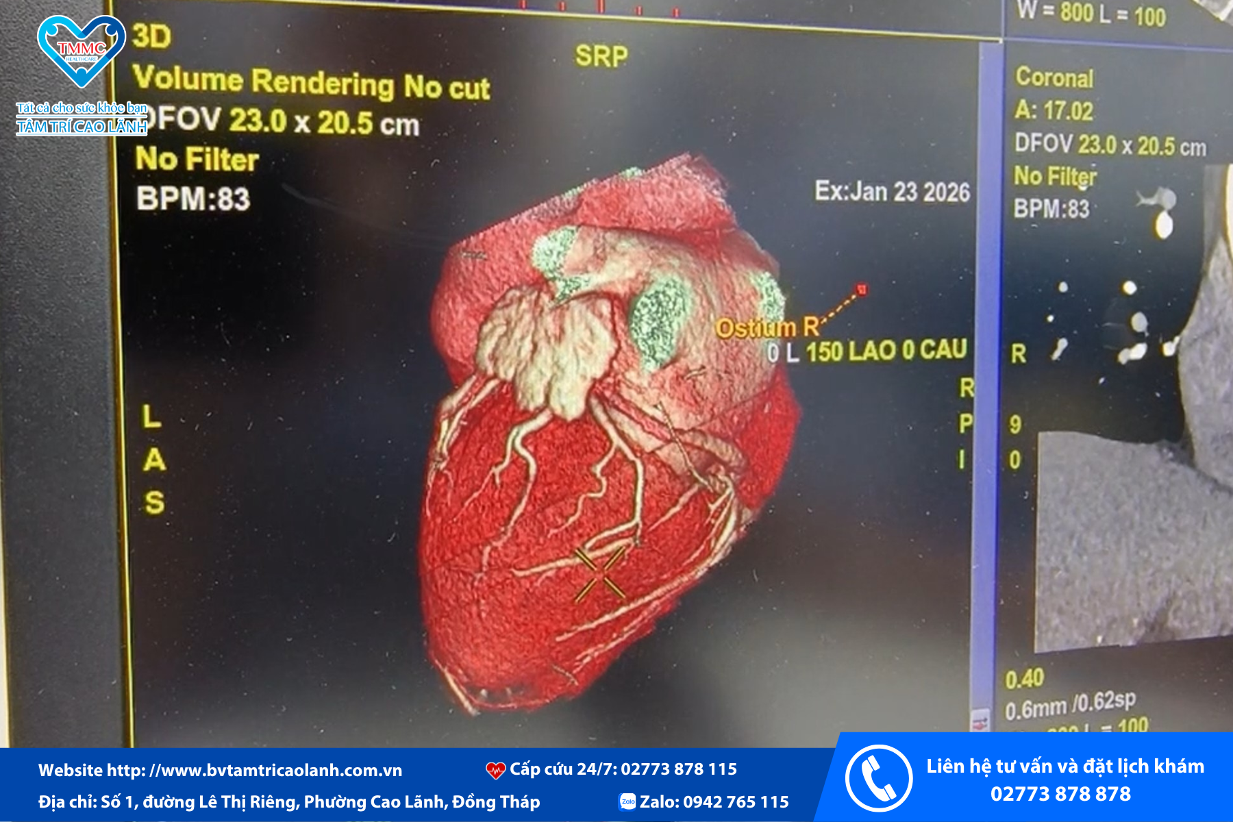 chup-tim-bang-may-ct-265-lat-cat