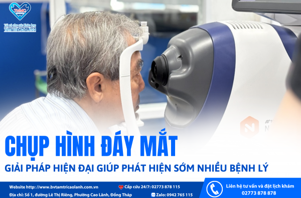 CHỤP HÌNH ĐÁY MẮT -  GIẢI PHÁP HIỆN ĐẠI: GIÚP PHÁT HIỆN SỚM NHIỀU BỆNH LÝ