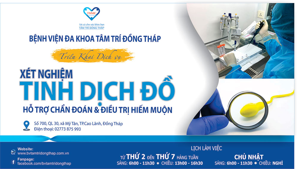 XN-TINH-DICH-DO