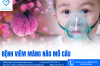 BỆNH VIÊM MÀNG NÃO MÔ CẦU