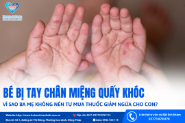 BÉ BỊ TAY CHÂN MIỆNG QUẤY KHÓC: VÌ SAO BA MẸ KHÔNG NÊN TỰ MUA THUỐC GIẢM NGỨA CHO CON