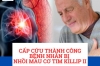 CẤP CỨU THÀNH CÔNG BỆNH NHÂN BỊ  NHỒI MÁU CƠ TIM KILLIP II HIẾM GẶP