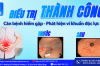 ABSCESS DẠ DÀY- CĂN BỆNH HIẾM GẶP ĐƯỢC ĐIỀU TRỊ THÀNH CÔNG TẠI BỆNH VIỆN TÂM TRÍ CAO LÃNH