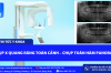 CHỤP X QUANG RĂNG TOÀN CẢNH – CHỤP TOÀN HÀM PANORAMA