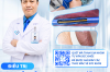 ĐIỀU TRỊ SUY GIÃN TĨNH MẠCH CHI DƯỚI BẰNG SÓNG CAO TẦN RFA – GIẢI PHÁP HIỆN ĐẠI GIÚP NGƯỜI BỆNH NHẸ NHÀNG HƠN TRONG ĐIỀU TRỊ
