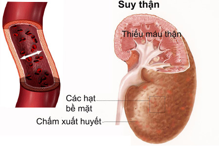 soi-nieu-quan-4