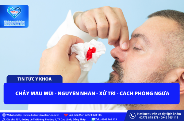 CHẢY MÁU MŨI - NGUYÊN NHÂN - XỬ TRÍ - CÁCH PHÒNG NGỪA