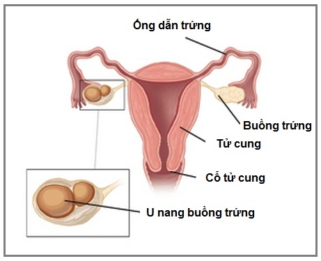 u-nang-buong-trung-4