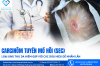CĂN BỆNH UNG THƯ DA HIẾM GẶP "NÚP BÓNG" DƯỚI NHỮNG NỐT CỨNG TRÊN DA ĐẦU