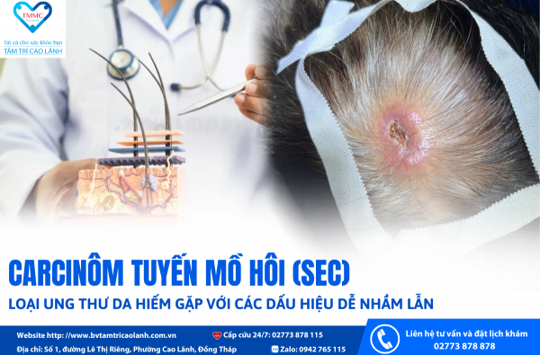 CĂN BỆNH UNG THƯ DA HIẾM GẶP "NÚP BÓNG" DƯỚI NHỮNG NỐT CỨNG TRÊN DA ĐẦU