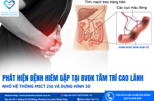 BỆNH HIẾM GẶP ĐƯỢC PHÁT HIỆN TẠI BVĐK TÂM TRÍ CAO LÃNH(TÂM TRÍ 2) NHỜ HỆ THỐNG MSCT 256 VÀ DỰNG HÌNH 3D