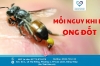 MỐI NGUY KỊCH KHI BỊ ONG ĐỐT