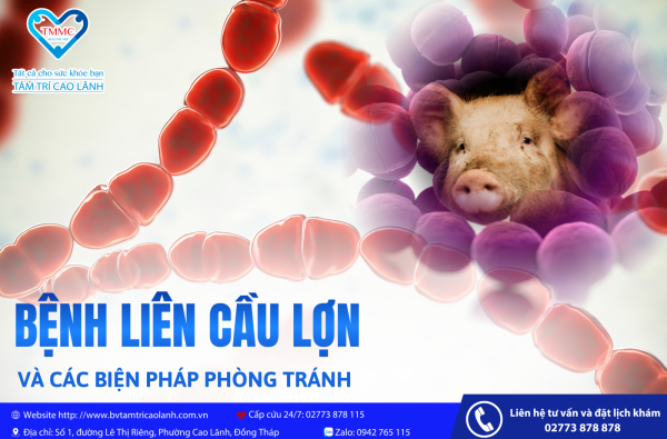 BỆNH LIÊN CẦU LỢN VÀ CÁC BIỆN PHÁP PHÒNG TRÁNH