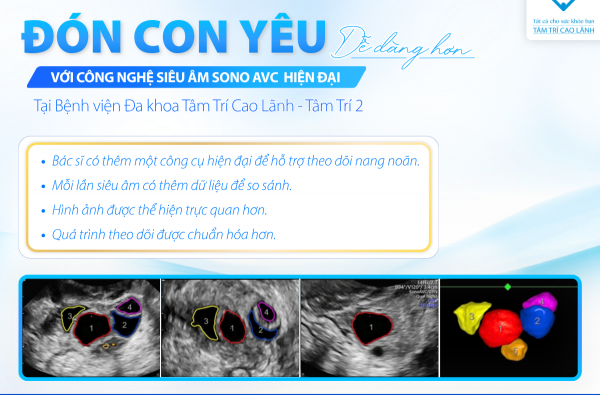 SONO AVC – CÔNG NGHỆ SIÊU ÂM HỖ TRỢ THEO DÕI NANG NOÃN CHUẨN XÁC, HIỆU QUẢ HƠN TRONG HÀNH TRÌNH TÌM CON
