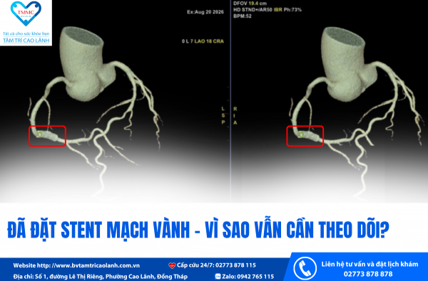 ĐÃ ĐẶT STENT MẠCH VÀNH – VÌ SAO VẪN CẦN THEO DÕI?