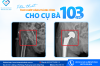 MỘT CÚ SỤM CHÂN BẤT NGỜ – KHI NGƯỜI CAO TUỔI CẦN ĐƯỢC THĂM KHÁM KỊP THỜI