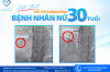 CẢNH BÁO NHỒI MÁU CƠ TIM Ở NGƯỜI TRẺ: CẤP CỨU THÀNH CÔNG BỆNH NHÂN NỮ 30 TUỔI