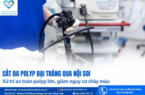 CẮT ĐA POLYP ĐẠI TRÀNG QUA NỘI SOI – XỬ TRÍ AN TOÀN POLYP LỚN, GIẢM NGUY CƠ CHẢY MÁU
