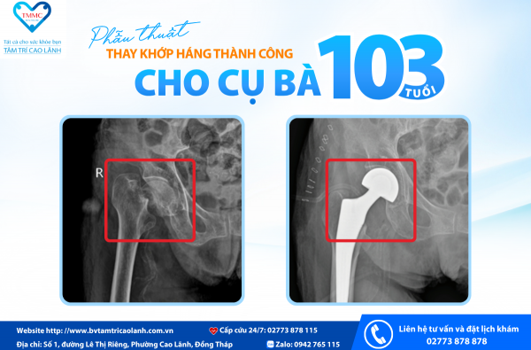 MỘT CÚ SỤM CHÂN BẤT NGỜ – KHI NGƯỜI CAO TUỔI CẦN ĐƯỢC THĂM KHÁM KỊP THỜI