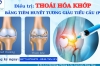 ĐIỀU TRỊ THOÁI HÓA KHỚP KHÔNG CẦN PHẪU THUẬT, BỆNH NHÂN CÓ PHỤC HỒI ĐƯỢC HAY KHÔNG