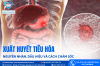 XUẤT HUYẾT TIÊU HÓA: NGUYÊN NHÂN, DẤU HIỆU VÀ CÁCH CHĂM SÓC