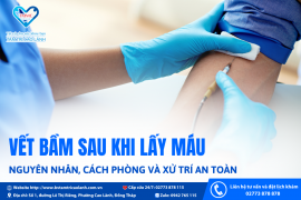 VẾT BẦM SAU KHI LẤY MÁU – NGUYÊN NHÂN, CÁCH PHÒNG VÀ XỬ TRÍ AN TOÀN