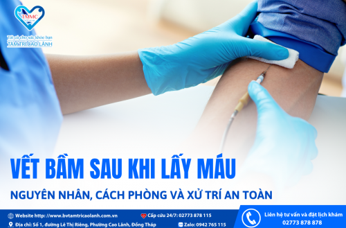 VẾT BẦM SAU KHI LẤY MÁU – NGUYÊN NHÂN, CÁCH PHÒNG VÀ XỬ TRÍ AN TOÀN