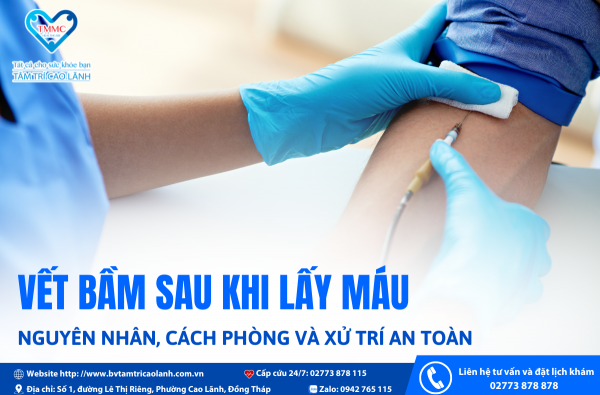 VẾT BẦM SAU KHI LẤY MÁU – NGUYÊN NHÂN, CÁCH PHÒNG VÀ XỬ TRÍ AN TOÀN