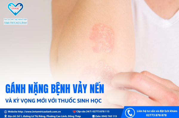 GÁNH NẶNG BỆNH VẢY NẾN VÀ   KỲ VỌNG MỚI VỚI THUỐC SINH HỌC