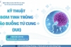 IUI – BƠM TINH TRÙNG VÀO BUỒNG TỬ CUNG LÀ GÌ?