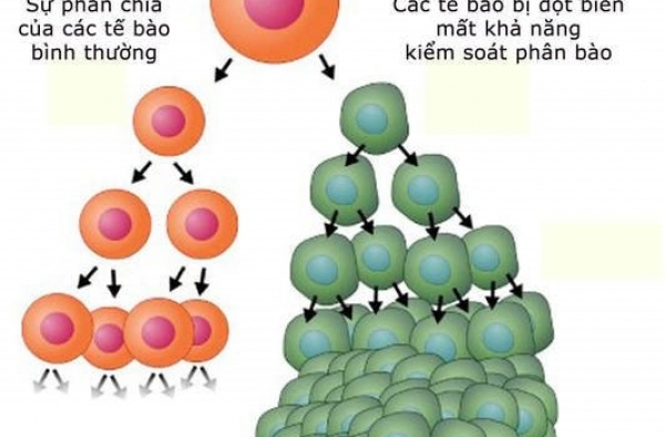 TẦM SOÁT SỚM NGUY CƠ UNG THƯ VÚ DI TRUYỀN BẰNG CÔNG NGHỆ PHÂN TÍCH ctDNA