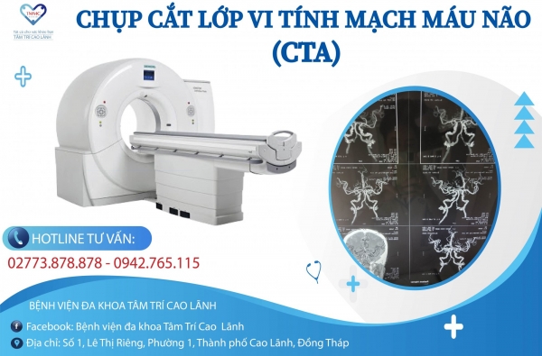CHẨN ĐOÁN BẤT THƯỜNG MẠCH MÁU NÃO VỚI KỸ THUẬT CHỤP CT MẠCH MÁU NÃO (CTA)