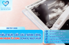 PHẪU THUẬT CẤP CỨU THÀNH CÔNG THAI NGOÀI TỬ CUNG ĐOẠN KẼ NGUY HIỂM