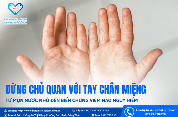 BỆNH TAY CHÂN MIỆNG